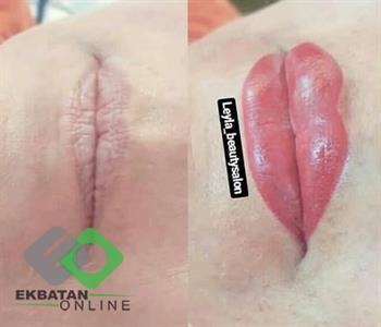 سالن زیبایی لیلا | آرایشگاه زنانه در اکباتان 1