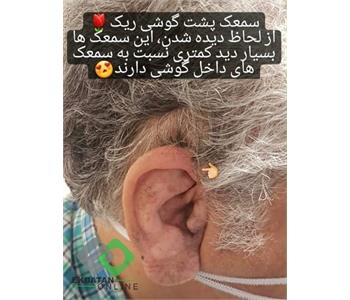 کلینیک شنوایی و سمعک اکو اکباتان 6