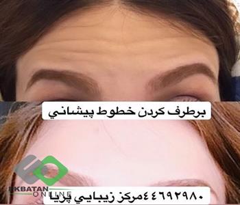 مرکز لاغری و لیزر پریا | لیزر در اکباتان 4