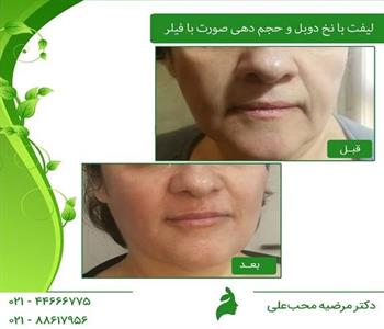 دکتر مرضیه محب علی 4