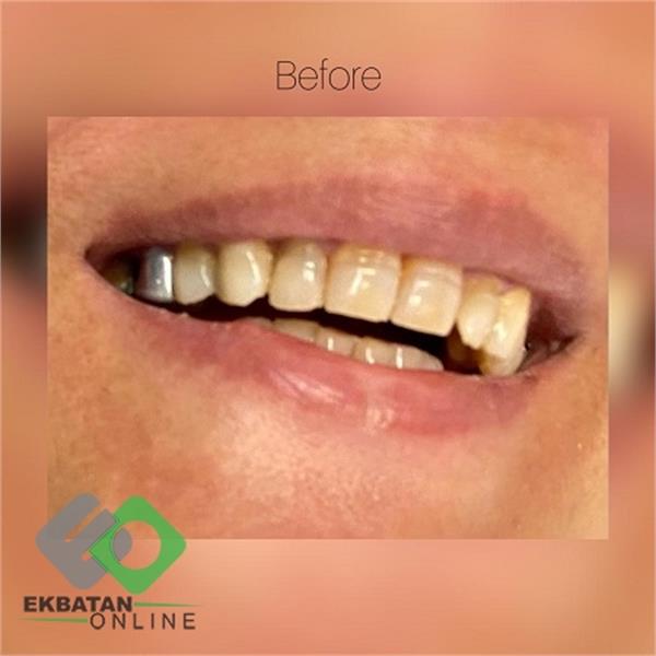 دکتر سحر حسین خانی | دندانپزشک در اکباتان 4