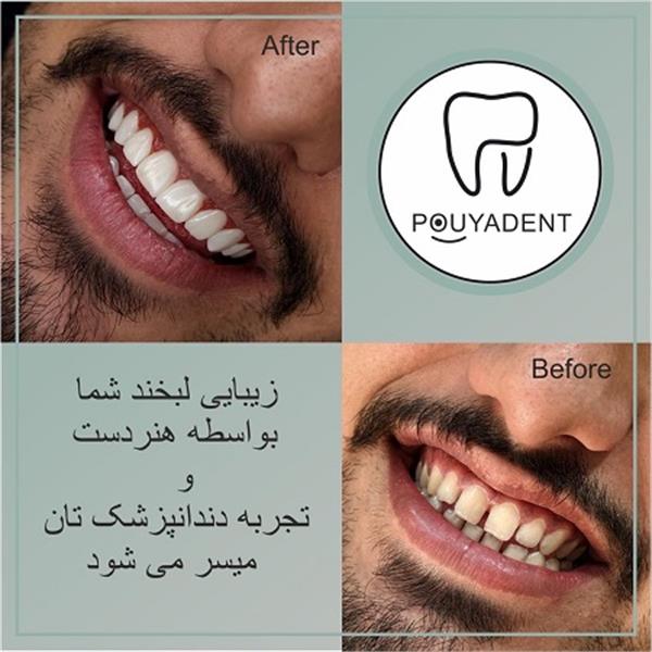 دکتر گیتی ذاکرانی - دندانپزشک در شهرک اکباتان 3