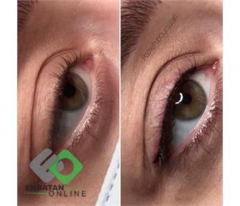 میکروبلدینگ راز | میکروبلدینگ در اکباتان 6