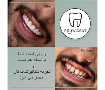 دکتر گیتی ذاکرانی - دندانپزشک در شهرک اکباتان 3