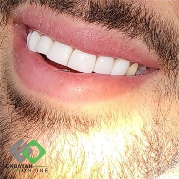 دکتر آتنا اخوان - دندانپزشک در شهرک اکباتان 1