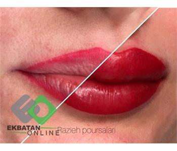 میکروبلدینگ راز | میکروبلدینگ در اکباتان 5