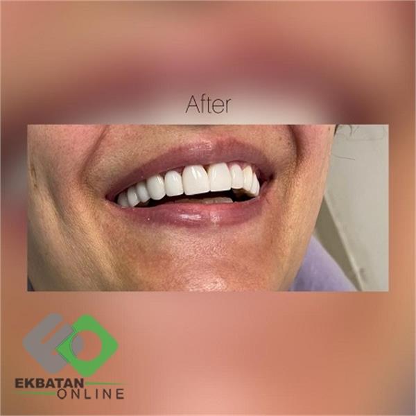 دکتر سحر حسین خانی | دندانپزشک در اکباتان 5