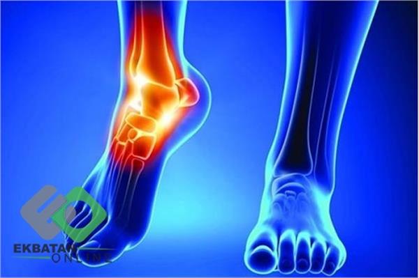 دکتر فریبرز توکل | پزشک ارتوپد در شهرک اکباتان 1