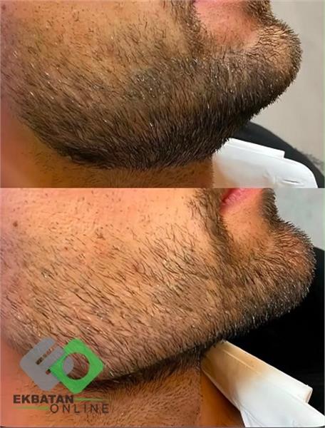 کلینیک زیبایی رولا - دکتر زیبایی در اکباتان 3