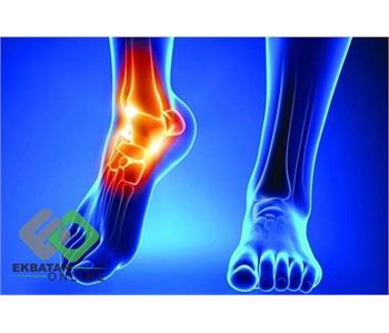 دکتر فریبرز توکل | پزشک ارتوپد در شهرک اکباتان 1