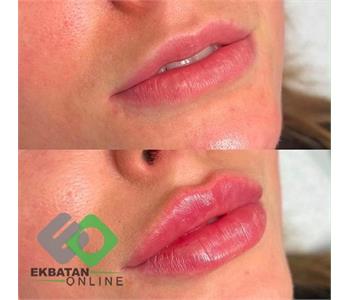کلینیک زیبایی رولا - دکتر زیبایی در اکباتان 5