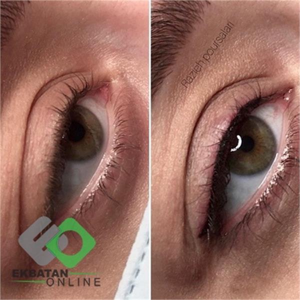 میکروبلدینگ راز | میکروبلدینگ در اکباتان 6