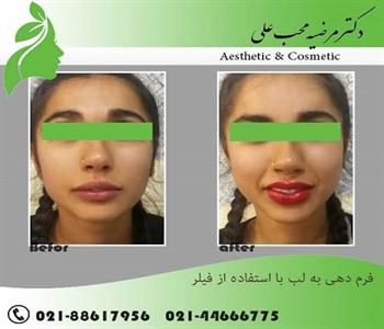 دکتر مرضیه محب علی 3