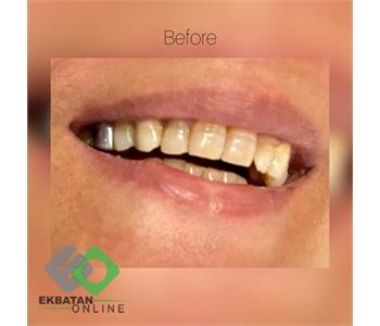 دکتر سحر حسین خانی | دندانپزشک در اکباتان 4