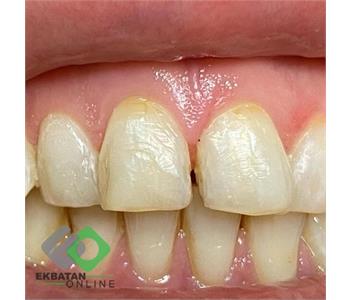 دکتر سحر حسین خانی | دندانپزشک در اکباتان 1