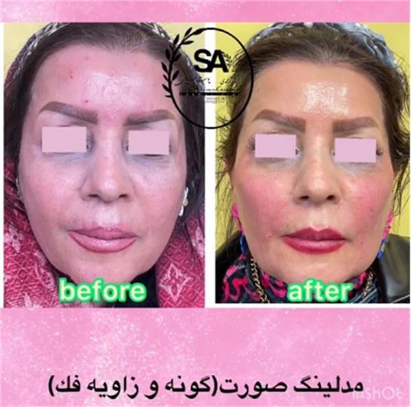 دکتر سهیلا علیمحمدى | دکتر پوست در اکباتان 3