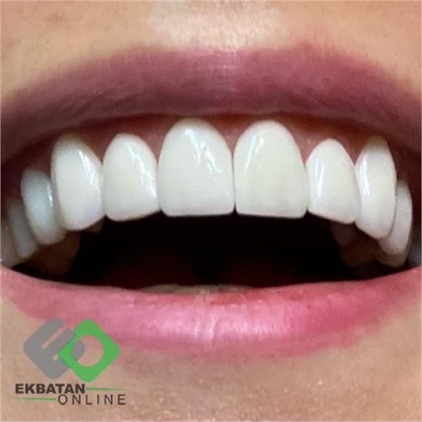 دکتر سحر حسین خانی | دندانپزشک در اکباتان 3