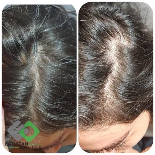 سالن زیبایی هکا - شهرک اکباتان 5