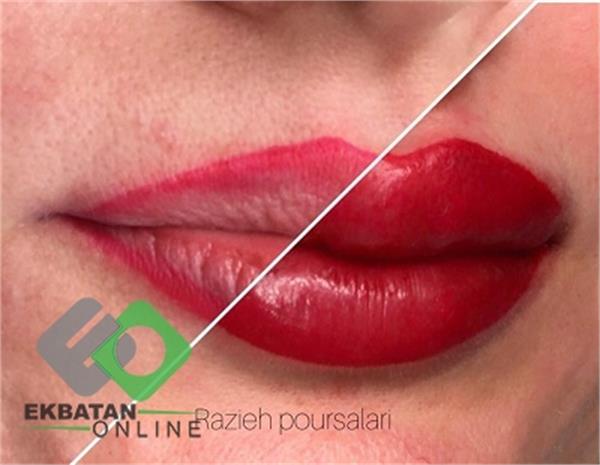 میکروبلدینگ راز | میکروبلدینگ در اکباتان 5