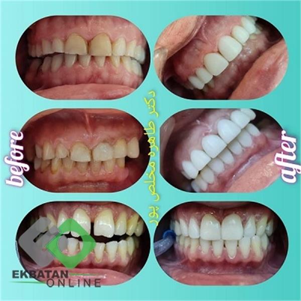 دکتر طاهره مخلص پور - دندانپزشک در شهرک اکباتان 4