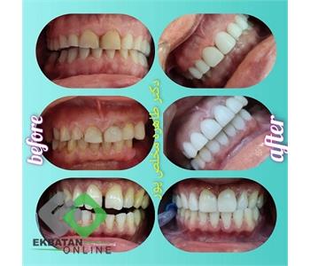 دکتر طاهره مخلص پور - دندانپزشک در شهرک اکباتان 4