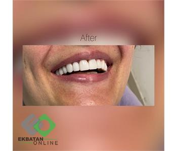 دکتر سحر حسین خانی | دندانپزشک در اکباتان 5