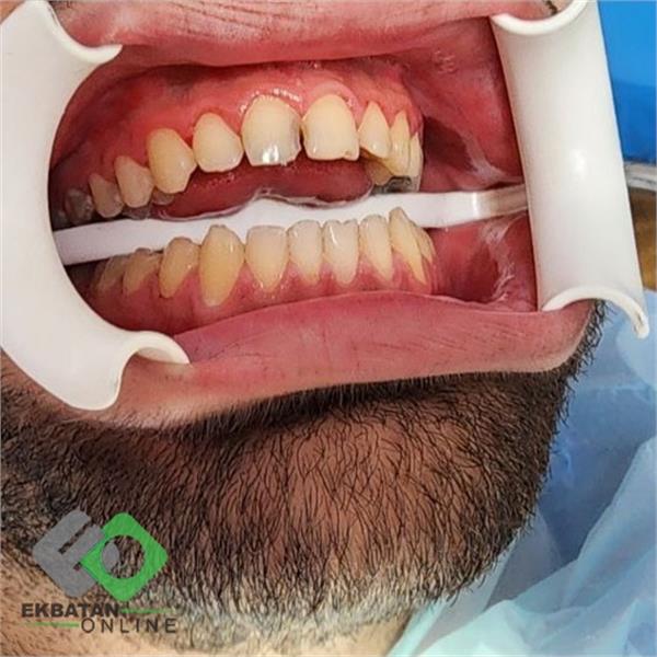 دکتر آتنا اخوان - دندانپزشک در شهرک اکباتان 2