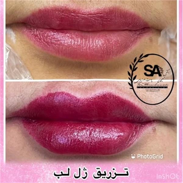 دکتر سهیلا علیمحمدى | دکتر پوست در اکباتان 6