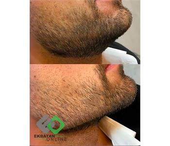 کلینیک زیبایی رولا - دکتر زیبایی در اکباتان 3