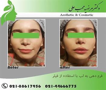 دکتر مرضیه محب علی 1