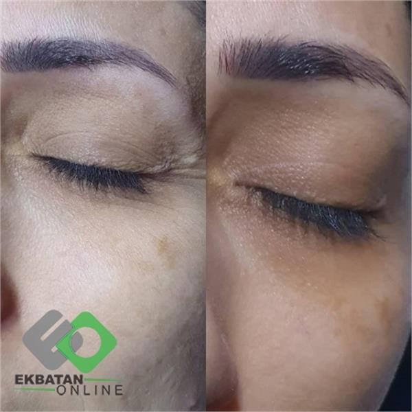 سالن زیبایی هکا - شهرک اکباتان 6