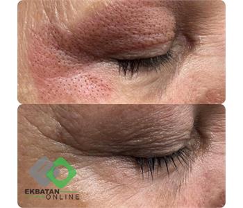 فرشته حکمتی منش 5