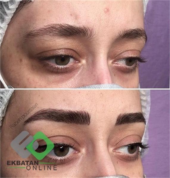 میکروبلدینگ راز | میکروبلدینگ در اکباتان 4