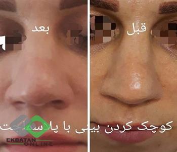 مرکز لاغری و لیزر پریا | لیزر در اکباتان 6