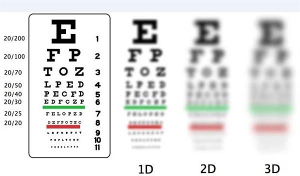 اپتومتریست باقری