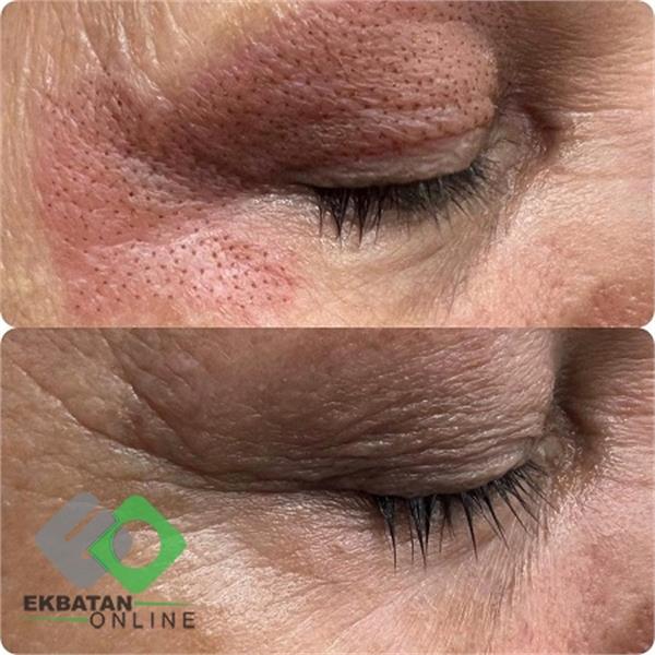 فرشته حکمتی منش 5