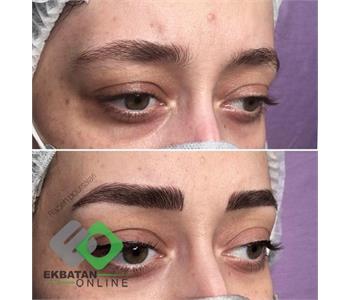 میکروبلدینگ راز | میکروبلدینگ در اکباتان 4