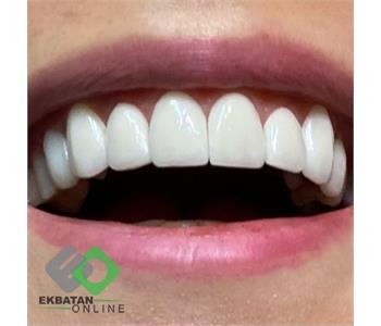 دکتر سحر حسین خانی | دندانپزشک در اکباتان 3